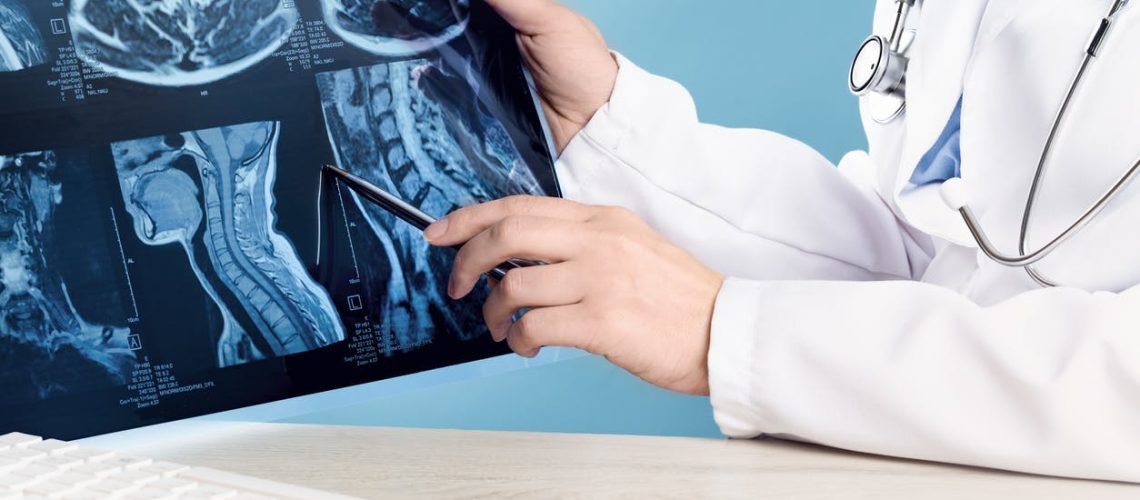 Tout savoir sur la moelle épinière